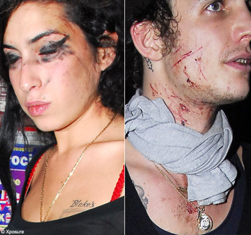 Amy Winehouse et son mari se battent en public