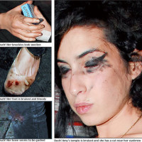 Amy Winehouse et son mari se battent en public