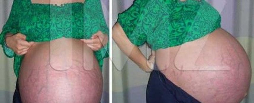 Photo femme enceinte d'octuplés