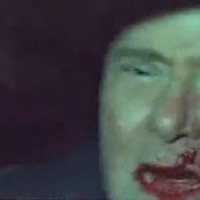 Vidéo agression visage Berlusconi