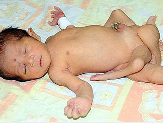 autre photo de bébé pakistanais 6 jambes